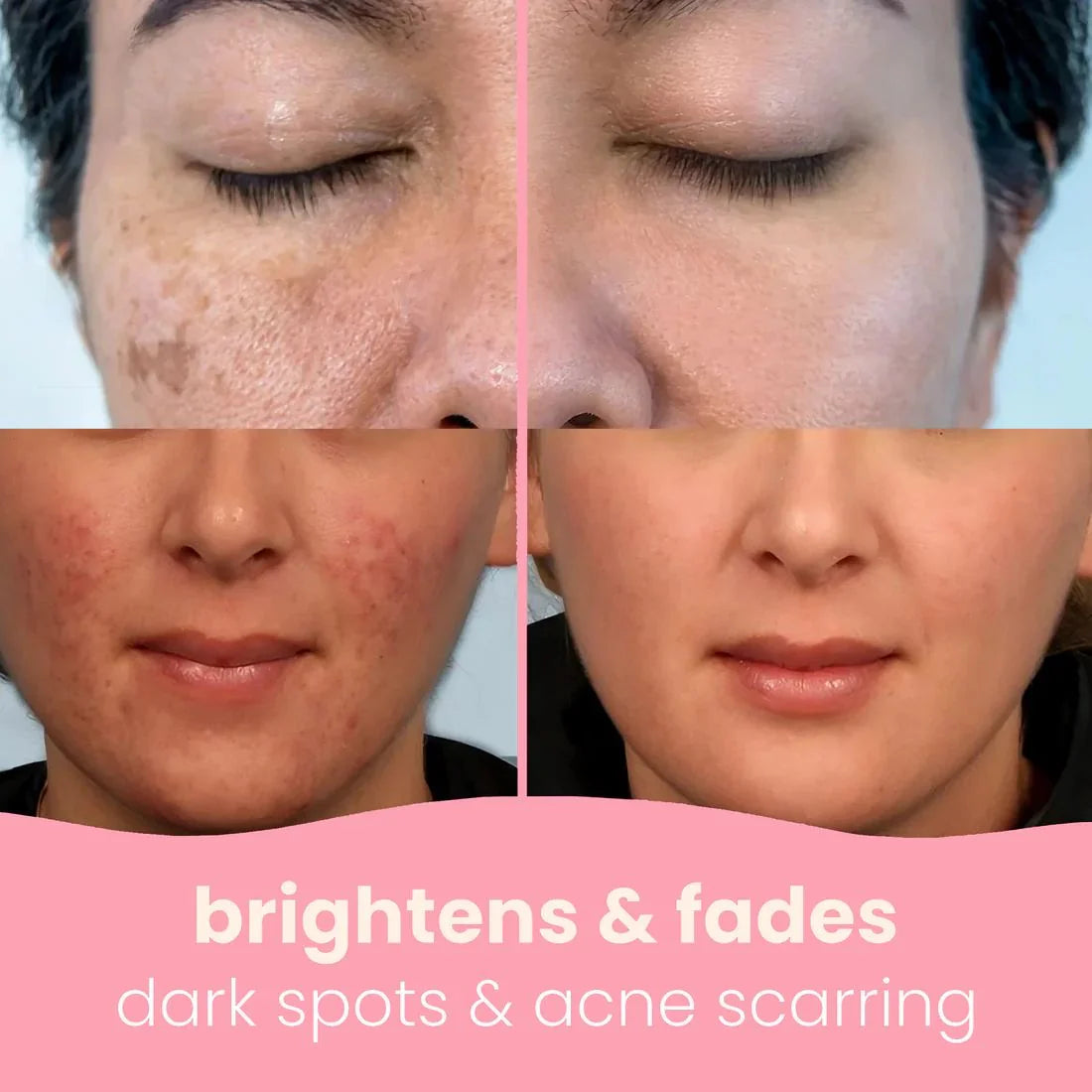 Turmeric & Kojic Acid Cleansing Pads