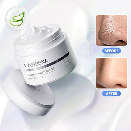 Lanbéna Blackhead Remover - Loréka Care
