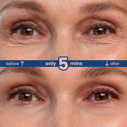 2 mins Wrinkle Eraser