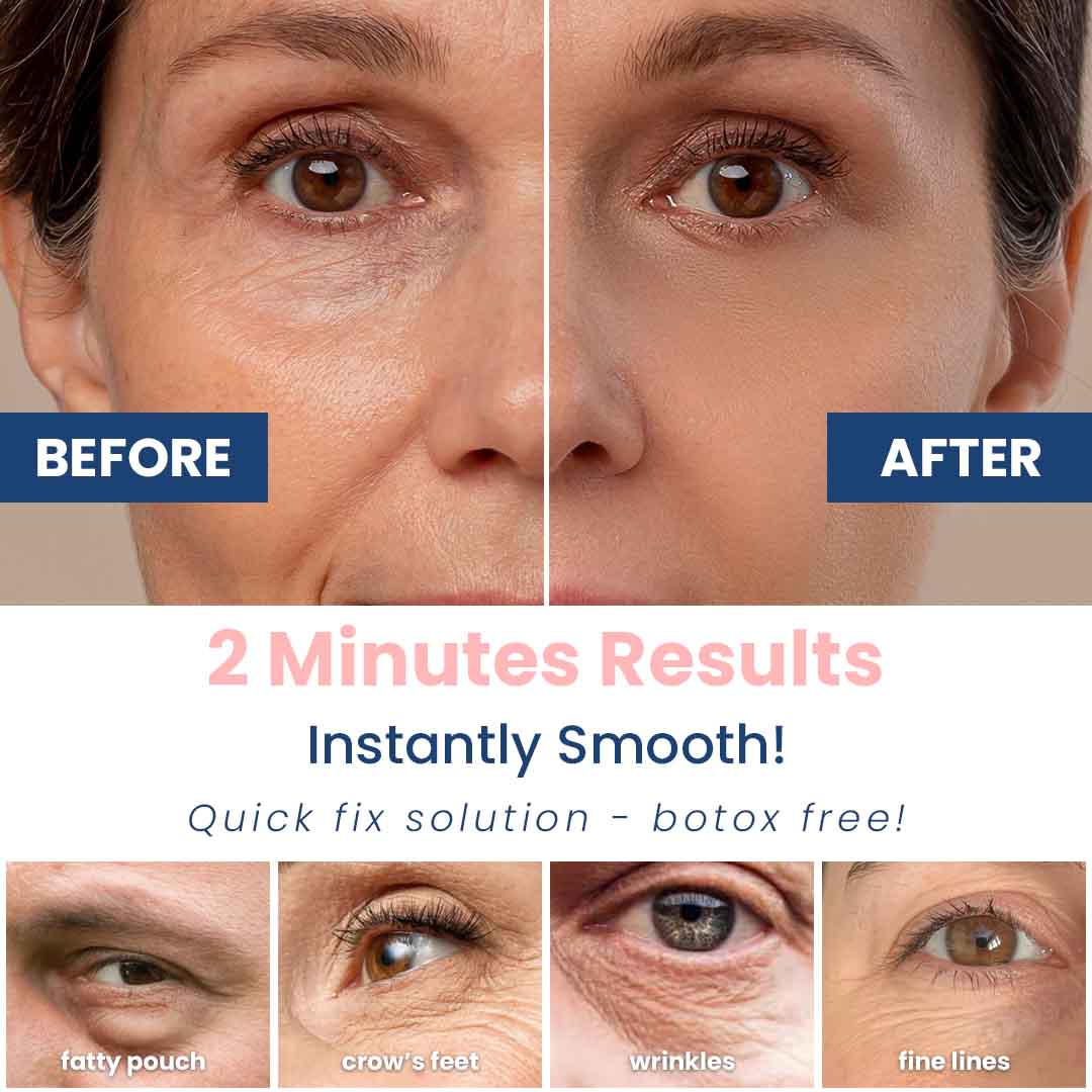2 mins Wrinkle Eraser