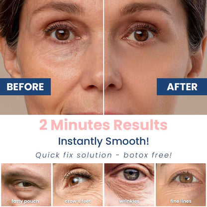 2 mins Wrinkle Eraser